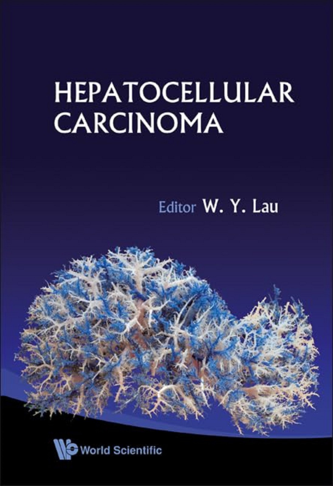 NEW: HEPATOCELLULAR CARCINOMA 1st Edition HARDCOVER 2008