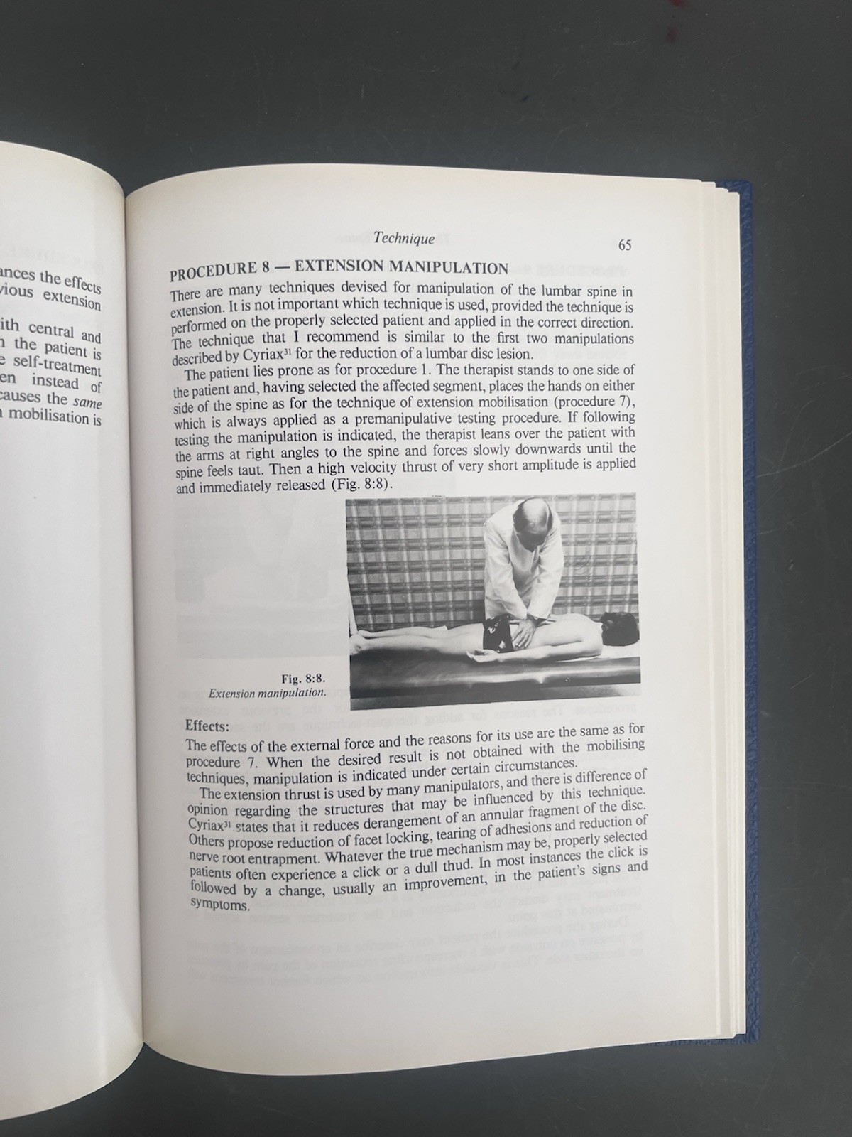 The Lumbar Spine Mechanical Diagnosis Mckenzie 1991 OMM OMT DPT Physical Therapy