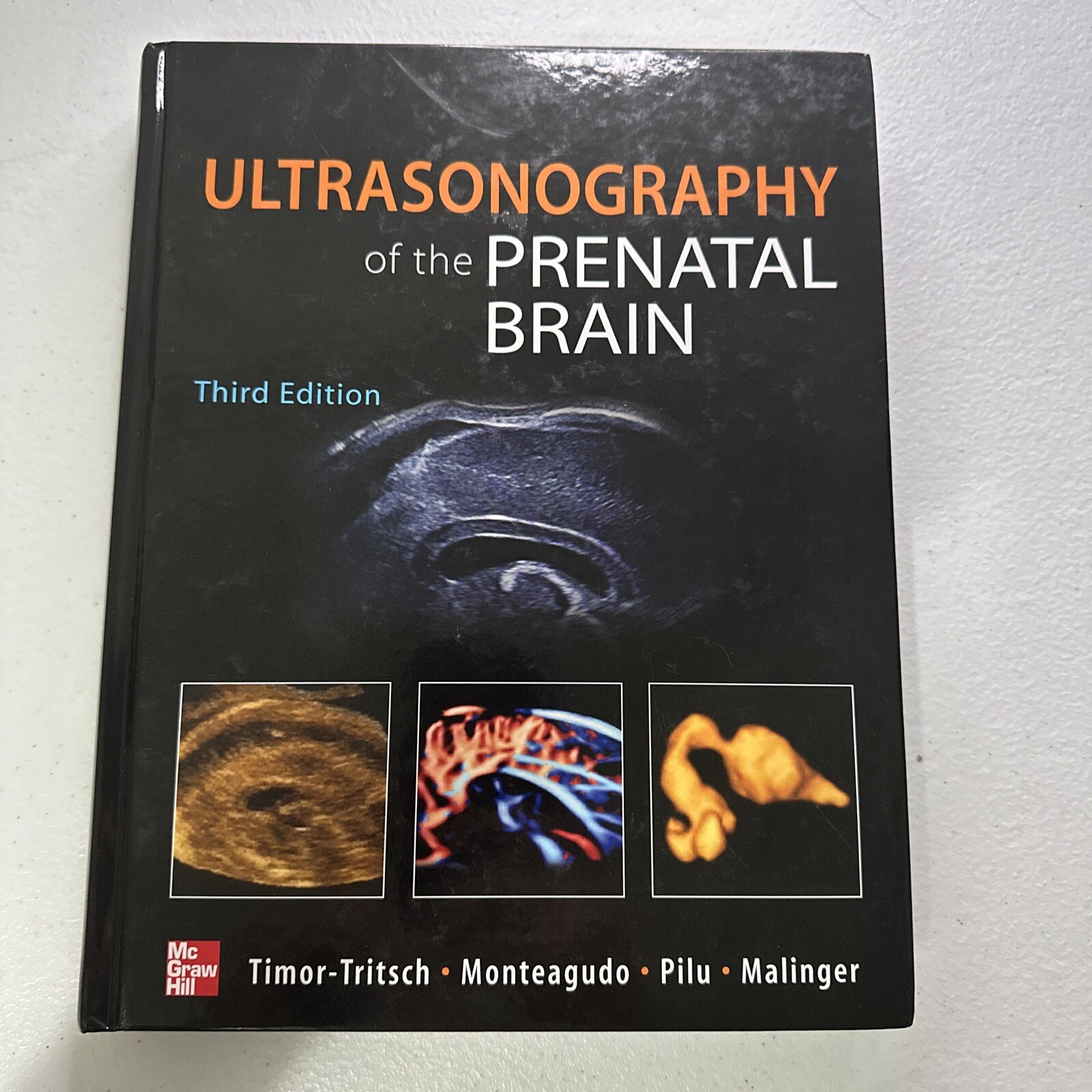 Ultrasonography of the Prenatal Brain, Third Edition by Ana Monteagudo, Ilan…