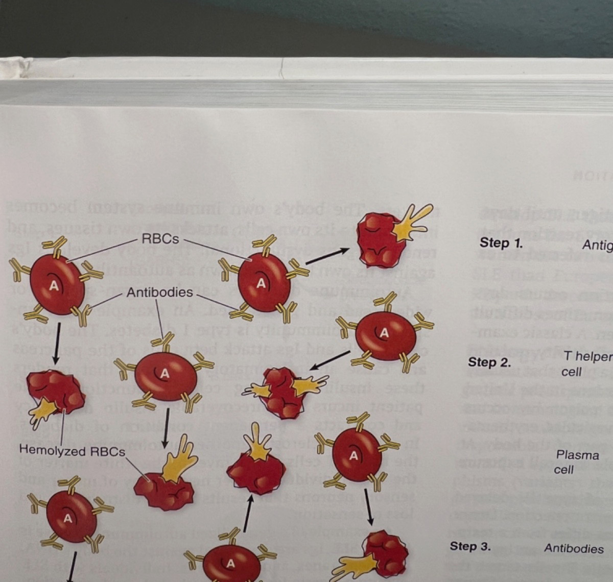 Davis Advantage for pathophysiology – 3rd edition (used access code) HC